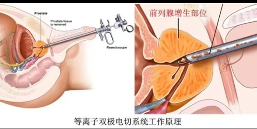 68196d60ec09d.png